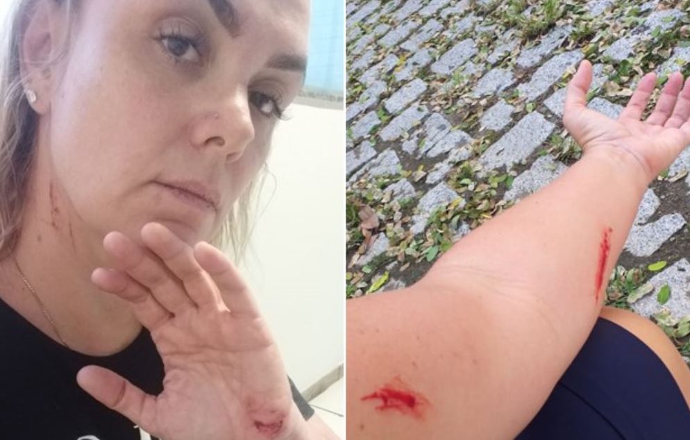 Ex-paquita, Ana Paula é filmada se machucando antes de acusar ex-marido por agressão Ex-paquita, Ana Paula é filmada se machucando antes de acusar ex-marido por agressão