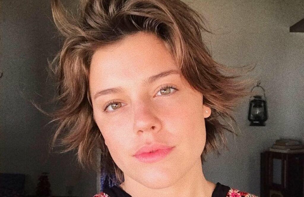 Atriz Alice Wegmann sofre acidente doméstico e é operada Atriz Alice Wegmann sofre acidente doméstico e é operada
