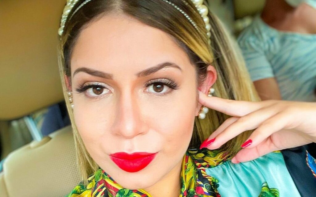Marília Mendonça sofre três queimaduras no rosto por causa de chapinha Marília Mendonça sofre três queimaduras no rosto por causa de chapinha