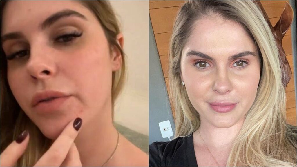 Grávida de gêmeos, Bárbara Evans surge sem filtro e revela espinhas no rosto Grávida de gêmeos, Bárbara Evans surge sem filtro e revela espinhas no rosto