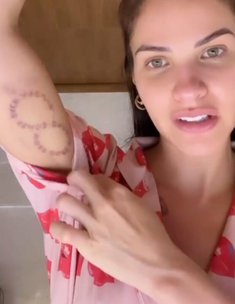 Andressa Suita está encontrando dificuldades para remover as tatuagens: "Não posso nem ver sol"  