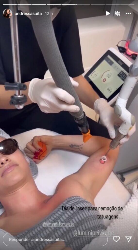 Andressa Suita sofre para remover tatuagem com símbolo do infinito que fez para amiga  